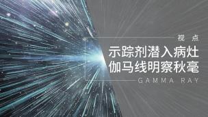 示踪剂潜入病灶 伽马线明察秋毫